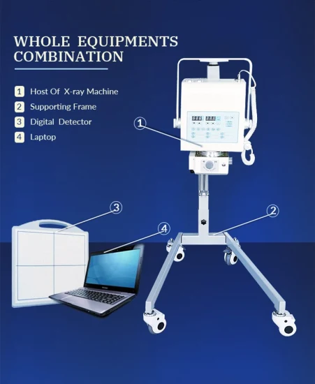 My-D019A 의료 병원 기기 디지털 휴대용 엑스레이 기계